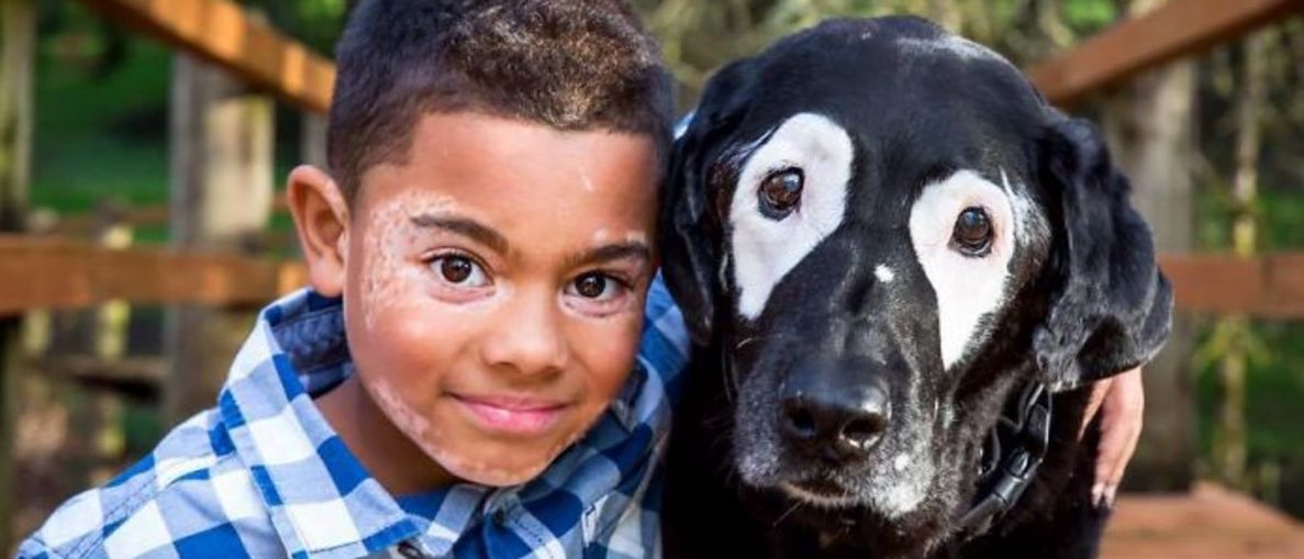 Unique in its own way.  A special boy meets a dog with the same disease as him and his life suddenly changes for the better