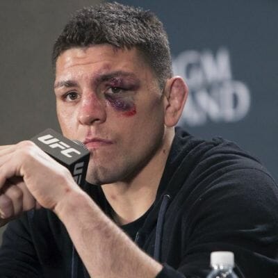 Nick Diaz