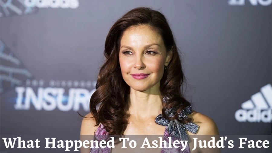 What Happened To Ashley Judds Face, How Ashley Judd Met With An Accident?