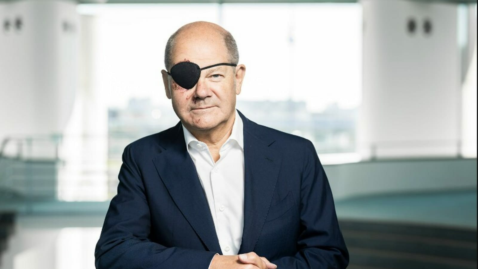 German Chancellor sports black eye patch, asks netizens to make memes on him