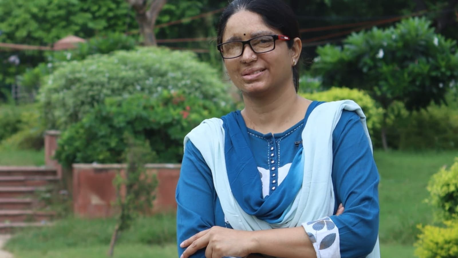 Meet Shaheen Malik, acid attack survivor who is empowering lives of other victims