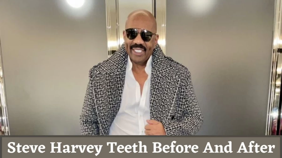 Steve Harvey Teeth Before And After, Is Steve Harveys Teeth Fake?